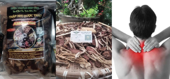 Y Học Cổ Truyền và Đau Vai Gáy