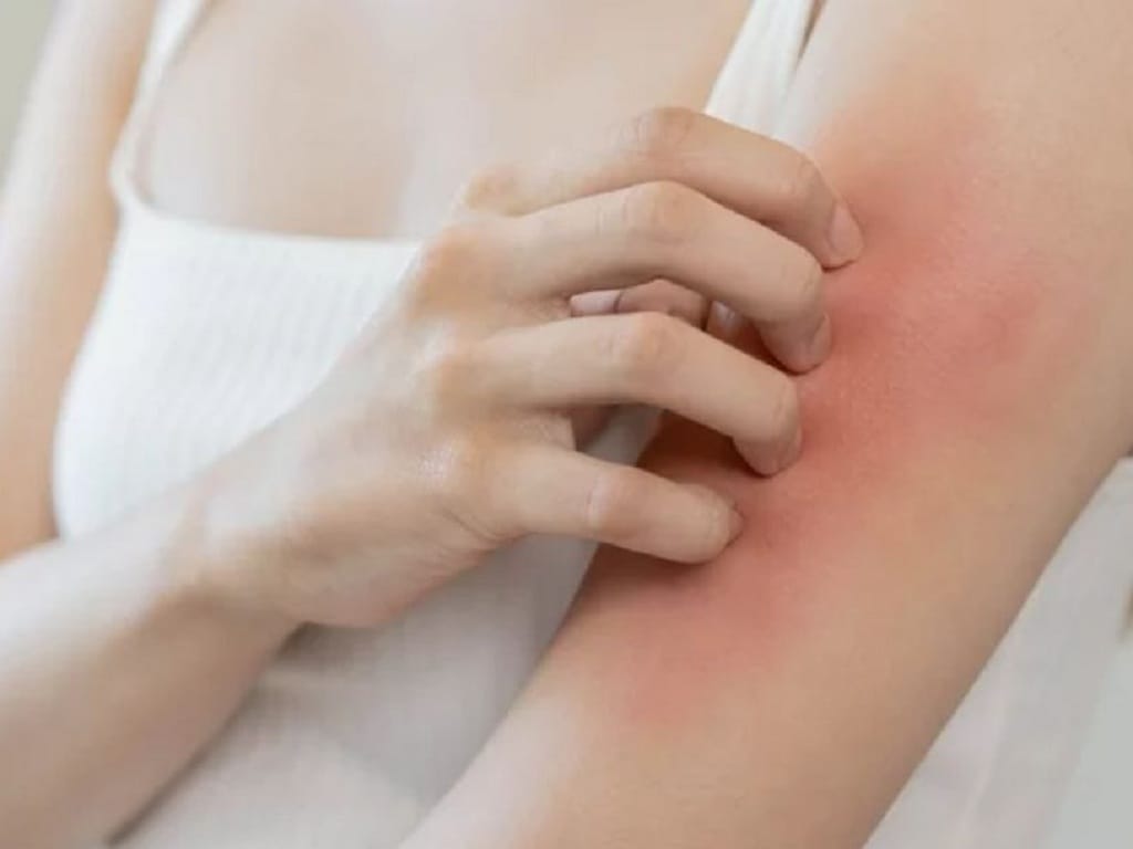 Ngứa da mùa xuân theo quan điểm Đông Y