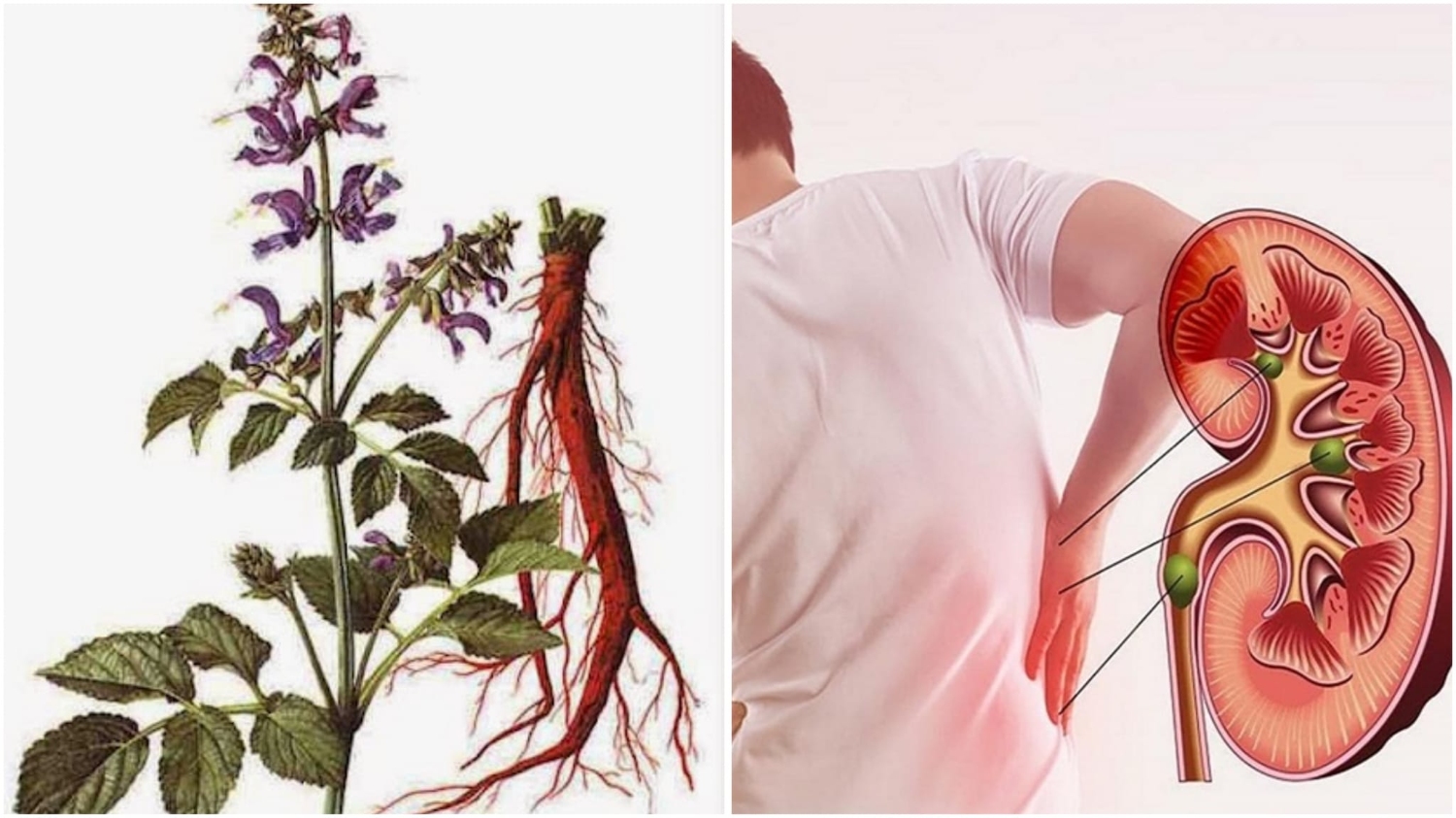 Đan Sâm và bệnh thận mạn